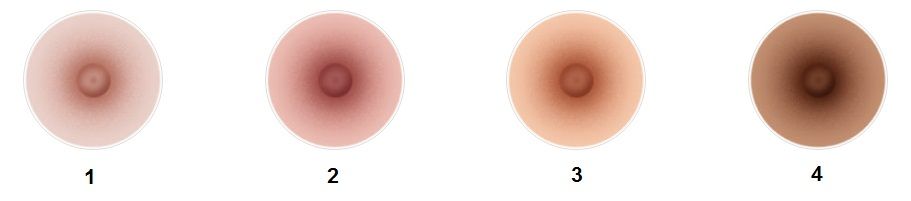 Areola color